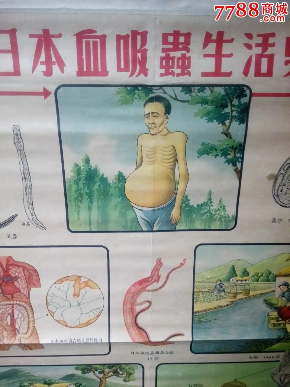 日本血吸虫(日本血吸虫成虫主要寄生于人体哪一部位)