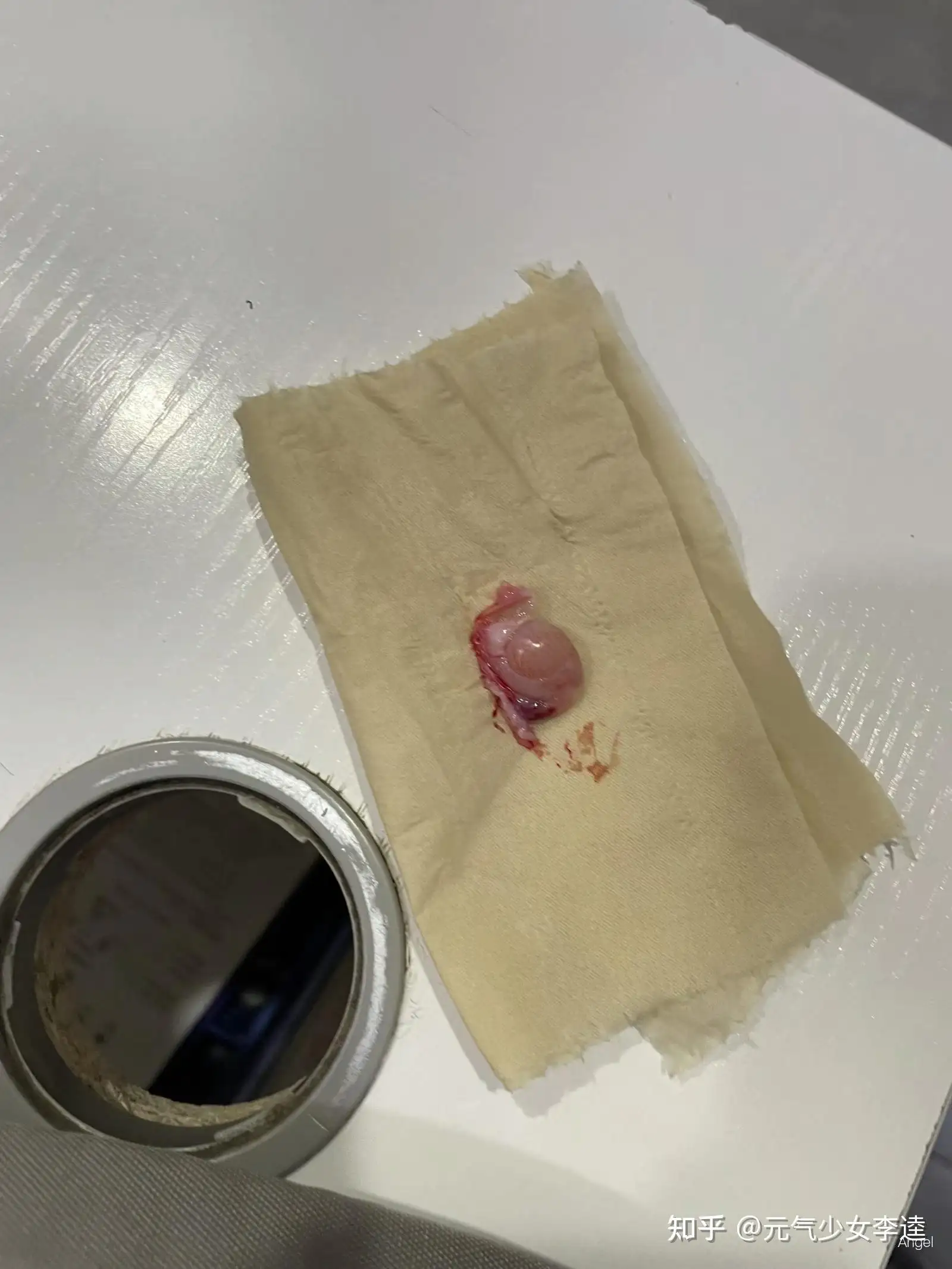 幼猫几个月可以绝育(幼猫几个月可以绝育了)
